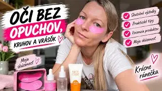 Oči bez opuchov, kruhov a vr&aacute;sok.