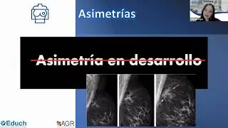 Actualizaciones Manual BI-RADS Sexta Edición