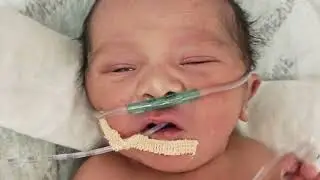 NICU// neonatal intensive care unit#oxyzen#support#ft#baby#cry#pat#vairalvideo#supportchannel