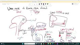 Lower Motor vs Upper Motor Neuron
