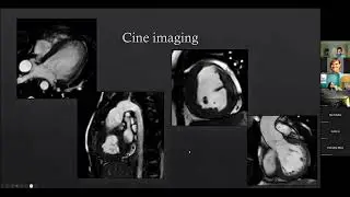 Magnetic Resonance Imaging of the Fontan Circulation - Sunil J. Ghelani, MD