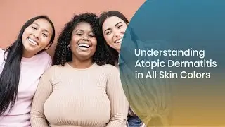 Understanding Atopic Dermatitis in Skin of Color