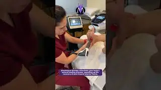 Marathon PT | Shockwave for Plantar Fasciitis