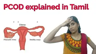 PCOD explained in Tamil|Indru Oru Information|
