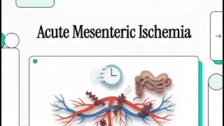 133 Острая мезентериальная ишемия