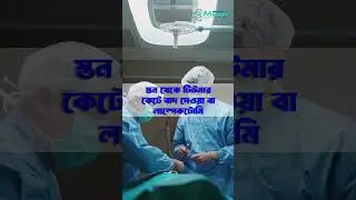 Breast Cancer Treatment A Comprehensive Guide | Understanding Options for Breast Cancer Treatment