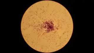 Bacteria Lactis Nosode (RIFE Healing Frequency)