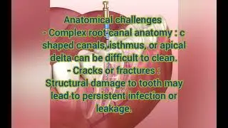 Causes of failure of endodontic treatment By Dr Abeer Mostafa