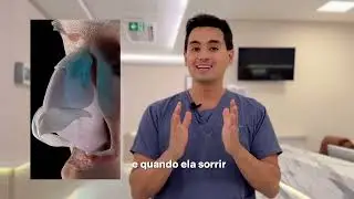 Rinoplastia: mais harmonia, funcionalidade e autoestima | Dr. Alexandre Audi