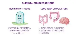 Necrotizing Enterocolitis NEC