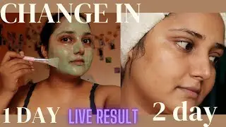 AMAZING GREEN CLAY MASK || DOT AND KEY GREEN CLAY MASK REVIEW