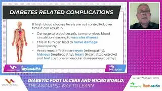 Diabetic foot ulcers and Microworld: The animated way to learn