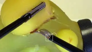 Surgical evaluation tool - Automated metrics with computer vision