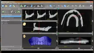 Aggiornamento vers.9.7 coDiagnostiX Scansione doppia