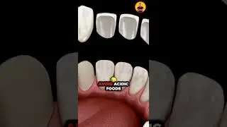 How to Protect Your Tooth Enamel ||#shorts #dentist #dental #dentistreview