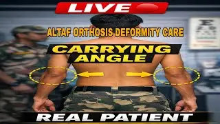 LIVE Orthosis Treatment 🔥 No Surgery