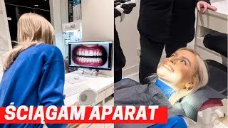 Jak wygląda demontaż aparatu ortodontycznego?😳😱| 2022