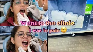 WISDOM TOOTH NE RULA DIYA 😭|| WISDOM TOOTH PAIN 😖|| WISDOM TOOTH CHECKUP||
