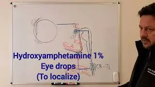 Horner's Syndrome (2) - pharmaceutical diagnosis