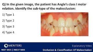 NEET MDS | INI-CET - Orthodontia - Occlusion & Classification Of Malocclusion | Explanatory Video