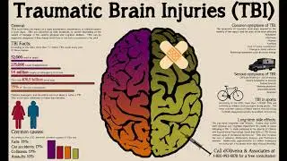 Concussion Safety with Oz Schaefer and Dr. Marissa