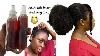 Perfect hair growth spray to grow inches in 2 MONTHS! Chemical Free And Inexpensive