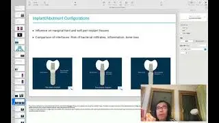 上浦歯科　研修医ゼミ2025   Tissue Integration of Dental Implants  3