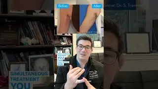 🤩#1 Non-Invasive Body Sculpting Tech #evolvex #plasticsurgeon #plasticsurgeryexpert #bodysculpting