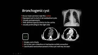Pediatric chest imaging V DRE Prof  Mamdouh Mahfouz HD