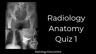 Radiology Anatomy Quiz 1 #radiologytutorials #radiology