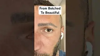 Follow my Brow Journey from Botched to Beautiful #eyebrows #botched