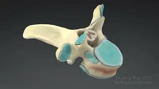 Vertebral Compression Insertion Device