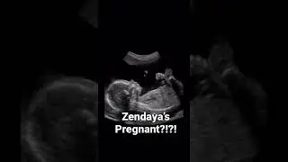 #zendaya #tomholland #pregnant #celebrities #celebrity #celebritynews