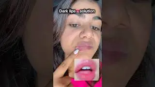 Dark lips 👄 solution at home ✅#shorts #trending #viral #skincare #lips #ytshorts