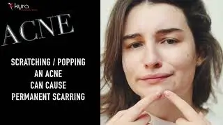 How to Get Rid Of Acne Scars Ludhiana Punjab | Acne Scar Treatment Ludhiana | Dr Vikas Gawri