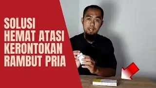 Solusi Hemat Mengatasi Kerontokan Rambut Pria Dengan Finasteride