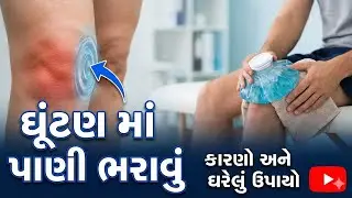 ઘૂંટણમાં પાણી ભરાવું: કારણો, લક્ષણો અને કાયમી ઈલાજ | Knee Effusion Treatment