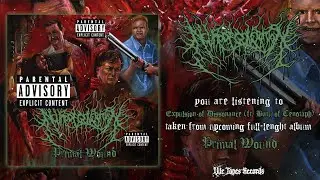 NEURODEGENERATION - EXPULSION OF DISSONANCE (FT. BATU &Ccedil;ETIN OF CENOTAPH) [SINGLE] (2026) SW EXCL
