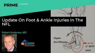 Update On Foot & Ankle Injuries In The NFL - Robert Anderson, MD