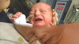 Andrew at SCBU