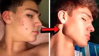 O resultado de BONS HÁBITOS! Evolução @Brae