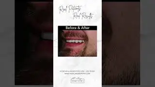 Real Patients - Real Results | Smile Transformation at The Village Dentistry