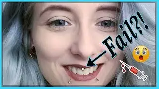 Mein neues Smiley Piercing...  Verstochen ?!😐