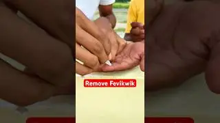 How To Remove Feviquick From Hand? #tricks #shorts