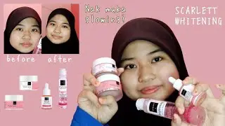 MUKA GLOWING? REVIEW BRIGHTLY EVER AFTER SERIES👀