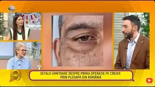 Follow us! - Premiera in Romania: OPERATIE PE CREIER PRIN PLEOAPA! Detalii uimitoare!