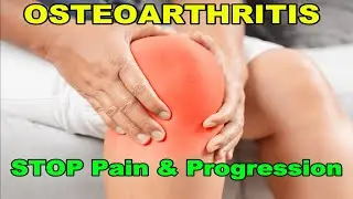 Top 6 Tips to Stop Pain and Slow Knee Osteoarthritis Progression