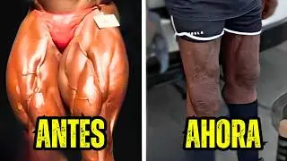 &iquest;Qu&eacute; Le Pas&oacute; a Las PIERNAS De Ronnie Coleman?