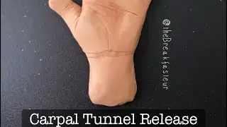 Playdough Surgery 🔪🖐🏻 - Carpal Tunnel Release