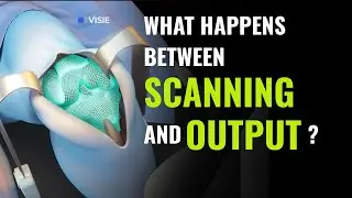 The Heavy Lifting Behind Real-Time 3D Surgery | VISIE